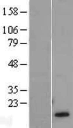 Novus Biologicals&trade;&nbsp;HBG1/2 Overexpression Lysate