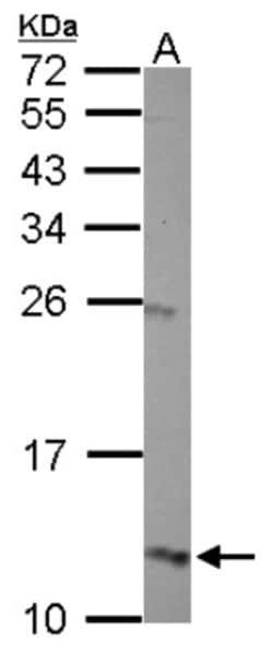 HBG1/2 Antibody, Novus Biologicals 0.1mL; Unlabeled:Antibodies, Polyclonal
