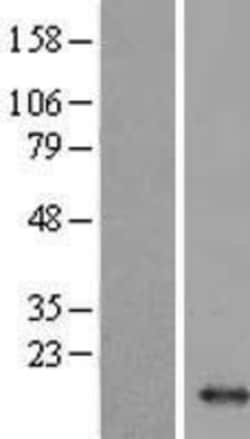 Novus Biologicals&trade;&nbsp;Hemoglobin mu Overexpression Lysate