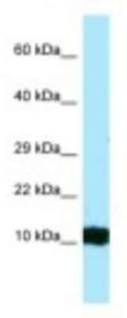 HBG1/2 Antibody, Novus Biologicals 0.05mg; Unlabeled:Antibodies, Polyclonal