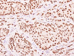 HENMT1 Antibody, Novus Biologicals 0.1mg; Unlabeled:Antibodies, Polyclonal