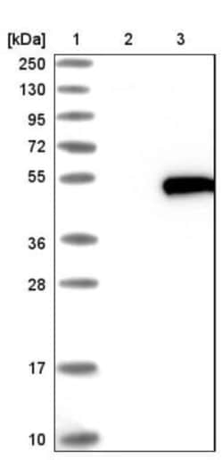 HENMT1 Antibody, Novus Biologicals 25 &mu;L | Buy Online | Novus Biologicals | Fisher Scientific