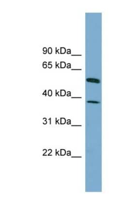 HepaCAM Antibody, Novus Biologicals 100&mu;L; Unlabeled:Antibodies, Polyclonal
