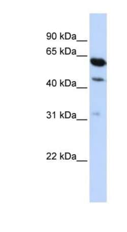 HEPACAM2 Antibody, Novus Biologicals:Antibodies:Primary Antibodies