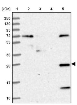 Heparan Sulfate 2-O-Sulfotransferase 1/HS2ST1 Antibody, Novus Biologicals 25 &mu;L | Buy Online | Novus Biologicals | Fisher Scientific
