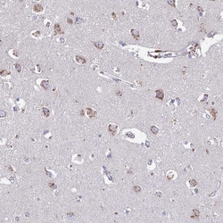 Heparan Sulfate 2-O-Sulfotransferase 1/HS2ST1 Antibody, Novus Biologicals 25 &mu;L | Buy Online | Novus Biologicals | Fisher Scientific