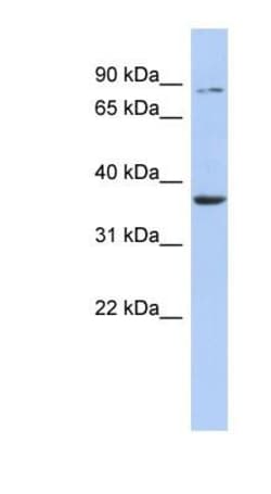 Heparan Sulfate 3-O-Sulfotransferase 1/HS3ST1 Antibody, Novus Biologicals 100 &mu;L | Buy Online | Novus Biologicals | Fisher Scientific