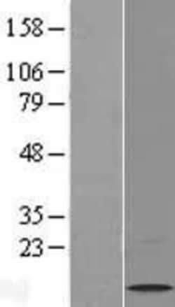 Novus Biologicals&trade;&nbsp;Hepcidin Antimicrobial Peptide Overexpression Lysate