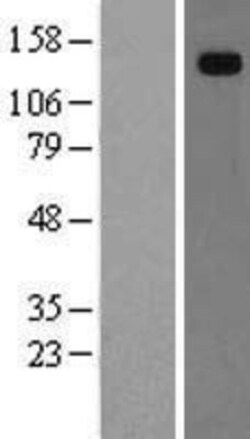 Novus Biologicals&trade;&nbsp;Hephaestin Overexpression Lysate