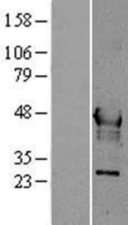 Novus Biologicals™ Hepsin Overexpression Lysate