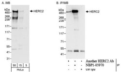 HERC2 Antibody, Novus Biologicals 100 &mu;L | Buy Online | Novus Biologicals | Fisher Scientific