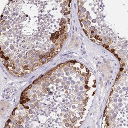 HERC5 Antibody, Novus Biologicals 0.1mL; Unlabeled:Antibodies, Polyclonal