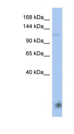 HERC5 Antibody, Novus Biologicals 100 &mu;L | Buy Online | Novus Biologicals | Fisher Scientific