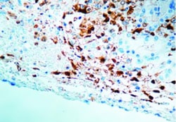 anti-Herpes Simplex Virus (HSV), Polyclonal, Novus Biologicals 6mL; Unlabeled:Antibodies,