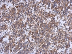 HERPUD1 Antibody, Novus Biologicals 0.1mL; Unlabeled:Antibodies, Polyclonal