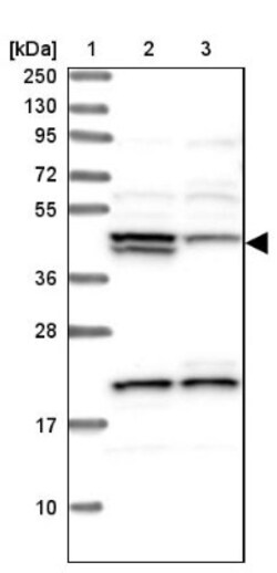 HERPUD1 Antibody, Novus Biologicals:Antibodies:Primary Antibodies