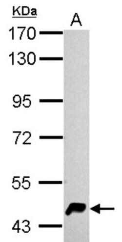 HERPUD1 Antibody, Novus Biologicals 0.1mL; Unlabeled:Antibodies, Polyclonal
