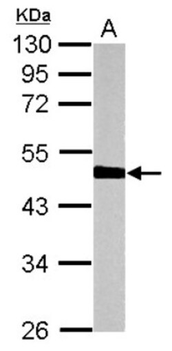 HERPUD1 Antibody, Novus Biologicals 0.1mL; Unlabeled:Antibodies, Polyclonal