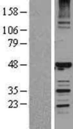 Novus Biologicals&trade;&nbsp;HERPUD1 Overexpression Lysate