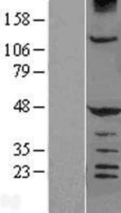 Novus Biologicals&trade;&nbsp;HERPUD1 Overexpression Lysate