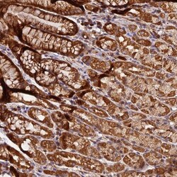HERPUD1 Antibody, Novus Biologicals:Antibodies:Primary Antibodies