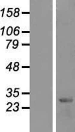 Novus Biologicals&trade;&nbsp;HES-1 Overexpression Lysate