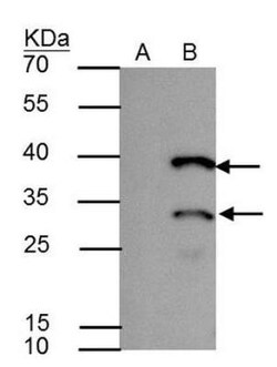 HES-1 Antibody, Novus Biologicals 100 microlitros | Buy Online | Novus Biologicals | Fisher Scientific