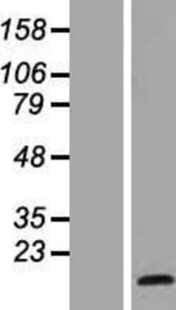 Novus Biologicals™ HES5 Overexpression Lysate