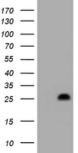 HES6 Antibody (OTI1D6), Novus Biologicals 0.1mL; Unlabeled:Antibodies,