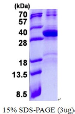 Novus Biologicals Recombinant Human HES7 His Protein 0.1 mg | Buy Online | Novus Biologicals&trade; | Fisher Scientific