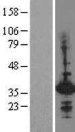Novus Biologicals&trade;&nbsp;HHEX Overexpression Lysate
