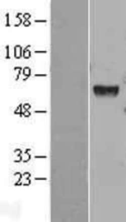 Novus Biologicals&trade;&nbsp;Hexosaminidase A/HEXA Overexpression Lysate