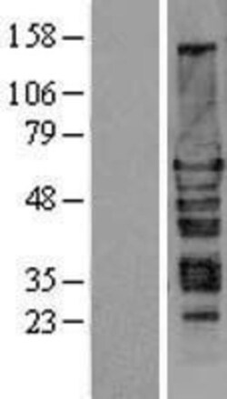 Novus Biologicals™ Hexim 1 Overexpression Lysate