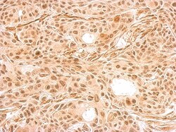 HEXIM2 Antibody, Novus Biologicals 0.1mL; Unlabeled:Antibodies, Polyclonal