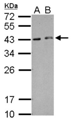 HEXIM2 Antibody, Novus Biologicals 0.1mL; Unlabeled:Antibodies, Polyclonal