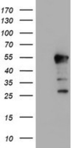 HEXO Antibody (OTI1B3), Novus Biologicals 0.1mL; Unlabeled:Antibodies,
