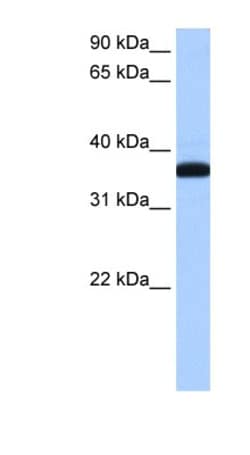 HEXO Antibody, Novus Biologicals 100&mu;L; Unlabeled:Antibodies, Polyclonal