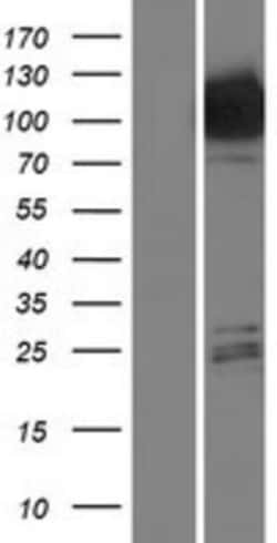 Novus Biologicals&trade;&nbsp;Hexokinase Type III Overexpression Lysate