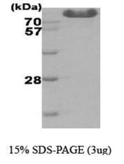 Novus Biologicals&trade;&nbsp;Recombinant Human Hexokinase Type III His Protein