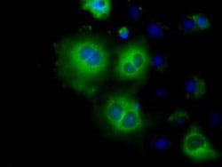 Hexokinase 2 Antibody (OTI4C5), Novus Biologicals 0.1mL; Unlabeled:Antibodies,