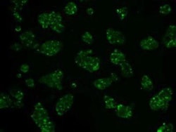 Hexokinase 2 Antibody (OTI4C5), Novus Biologicals 0.1mL; Unlabeled:Antibodies,