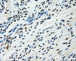 Hexokinase 2 Antibody (OTI4C5), Novus Biologicals 0.1mL; Unlabeled:Antibodies,
