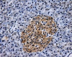 Hexokinase 2 Antibody (OTI4C5), Novus Biologicals 0.1mL; Unlabeled:Antibodies,