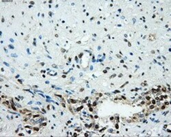 Hexokinase 2 Antibody (OTI4C5), Novus Biologicals 0.1mL; Unlabeled:Antibodies,