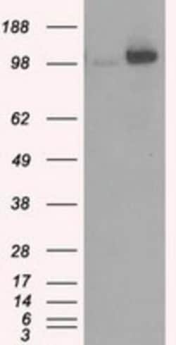 Hexokinase 2 Antibody (OTI4C5), Novus Biologicals 0.1mL; Unlabeled:Antibodies,