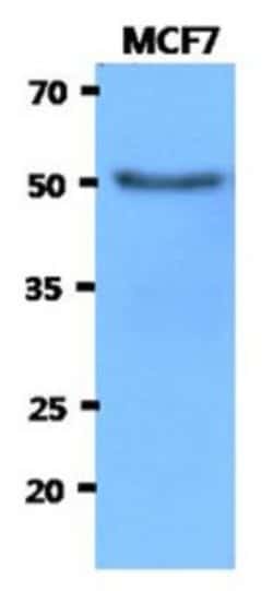 Hexosaminidase A/HEXA Antibody (20F1) - BSA Free, Novus Biologicals 100&mu;L;