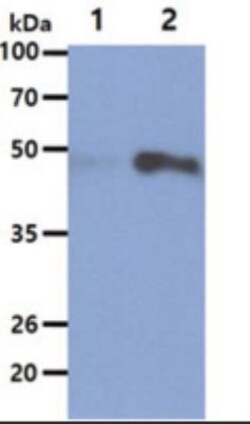 Hexosaminidase A/HEXA Antibody (20F1) - BSA Free, Novus Biologicals 100&mu;L;