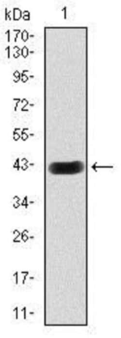 Hexosaminidase A/HEXA Antibody (3F10) - BSA Free, Novus Biologicals 0.1mL;