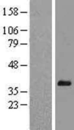 Novus Biologicals&trade;&nbsp;Hey L Overexpression Lysate