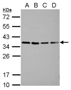 HEY1 Antibody, Novus Biologicals 0.1mL; Unlabeled:Antibodies, Polyclonal